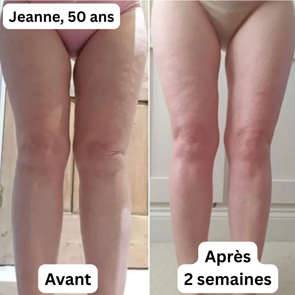 Couteau fascia électrique Pro – Remodelage, drainage et bien-être ciblé