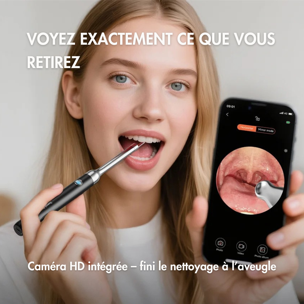 Kit de retrait de pierres d’amygdale avec caméra HD