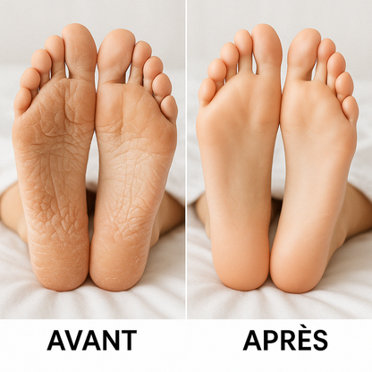 Chaussettes de nuit hydratantes – Offrez à vos pieds un soin réparateur