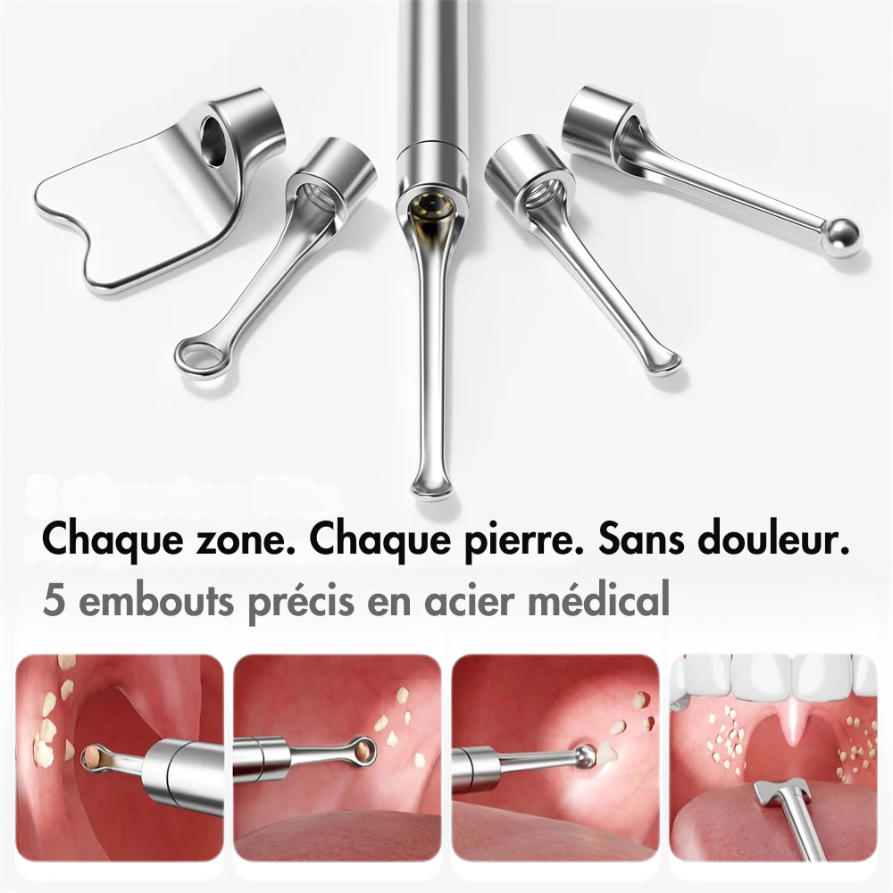 Kit de retrait de pierres d’amygdale avec caméra HD