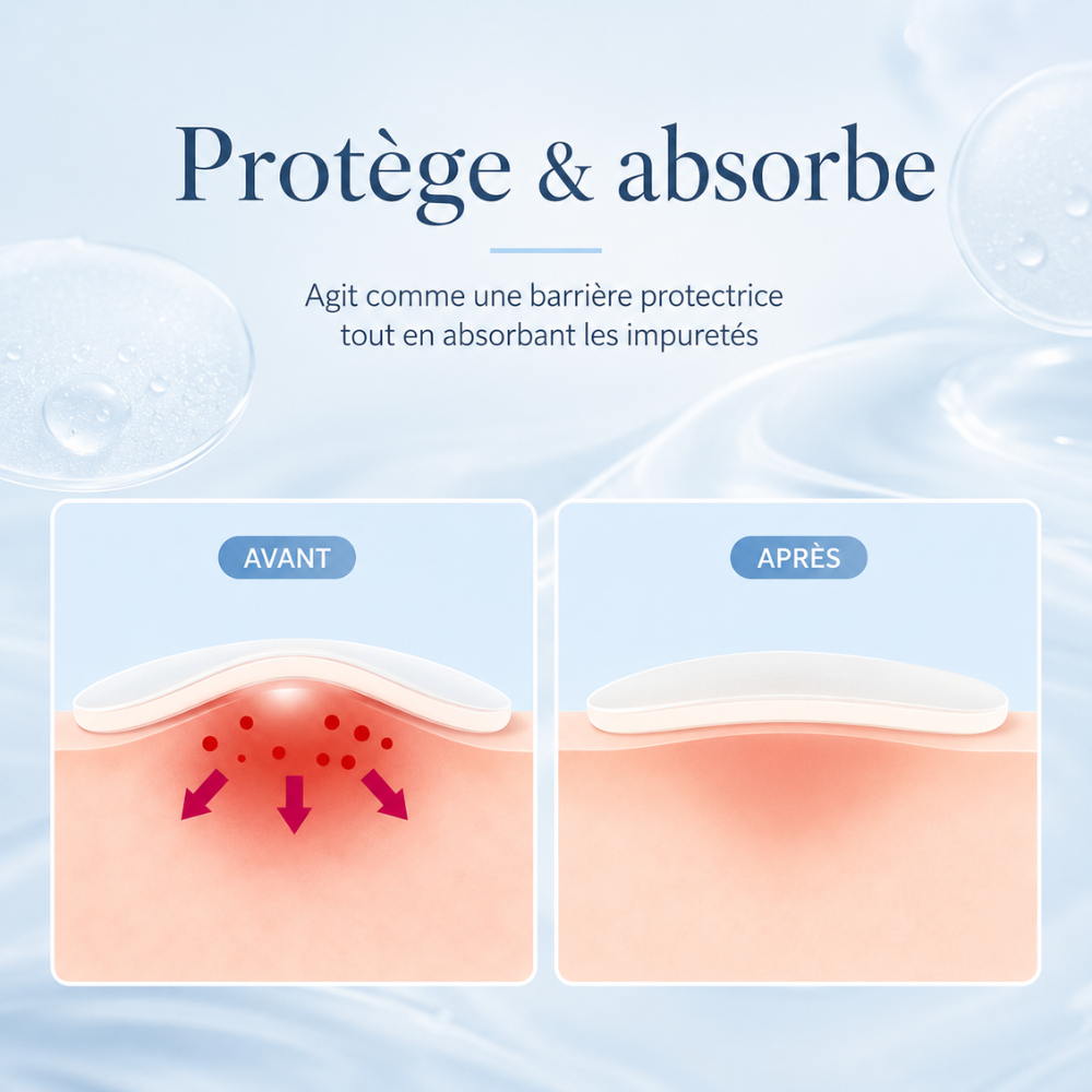 Patchs boutons hydrocolloïdes – 360 pièces