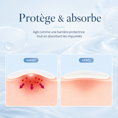 Patchs boutons hydrocolloïdes – 360 pièces