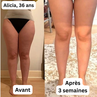 Couteau fascia électrique Pro – Remodelage, drainage et bien-être ciblé