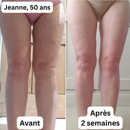 Couteau fascia électrique Pro – Remodelage, drainage et bien-être ciblé